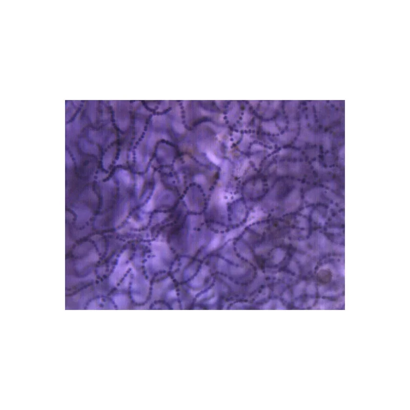 ibspot-45881447